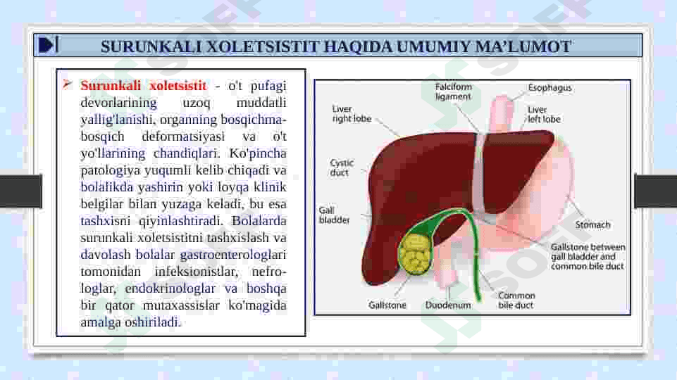 SURUNKALI XOLETSISTIT 3