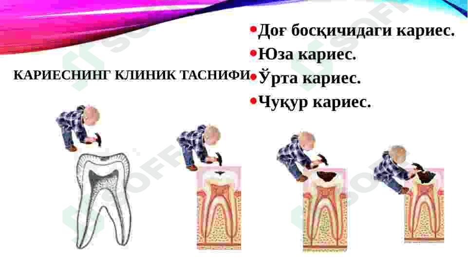 KARIES KASALLIGINING PROFILAKTIKASI 3