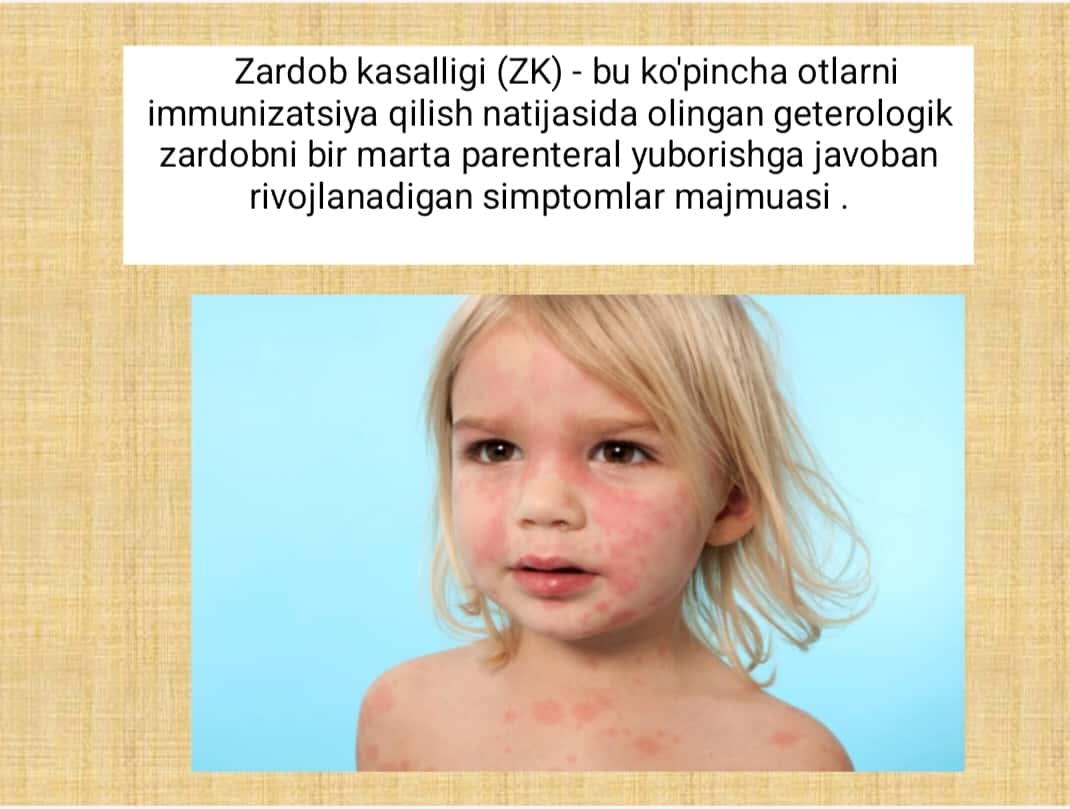 Zardob kasalligi 1