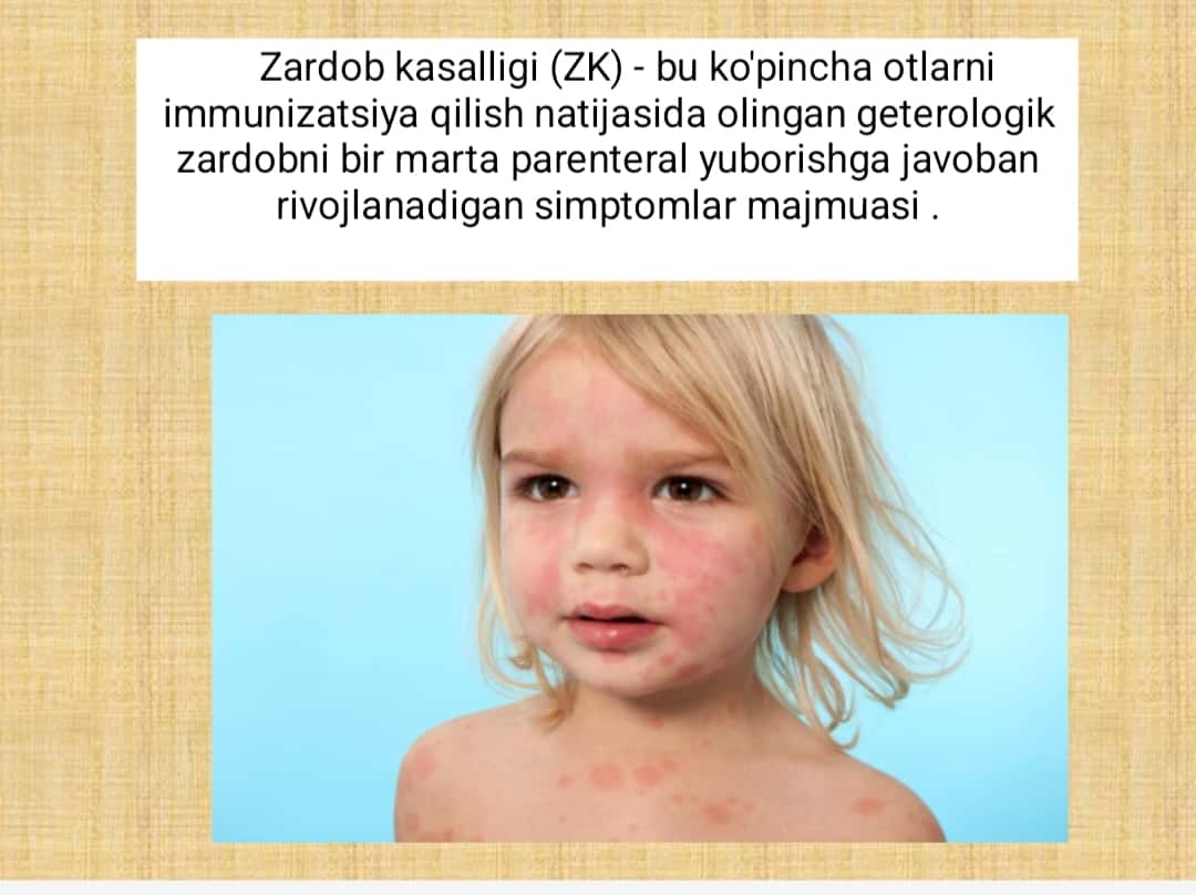 Zardob kasalligi 1