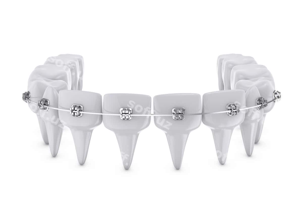Tish qisqartmalari | Dental brackets 1