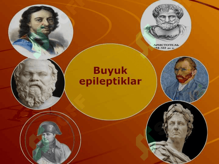 ISTERIYA VA EPILEPSIYA KASALLIKLARI SABABLARI BELGILARI ASORATLARI OLDINI OLISH VA DAVOLASH. 2