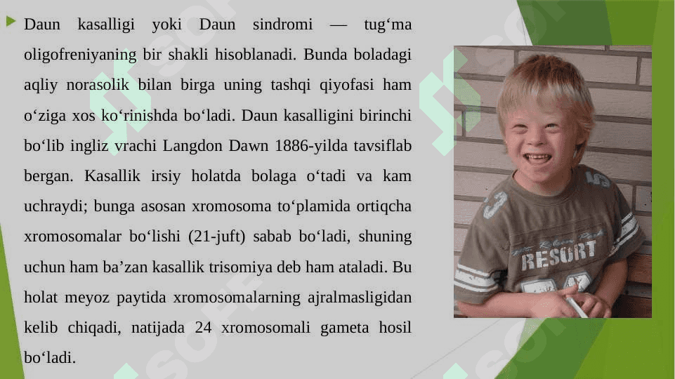 Daun sindromi 3