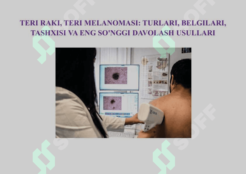 Teri raki, Teri melanomasi turlari Mohidi 2