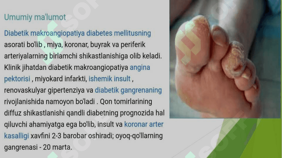 Diabetik makroangiopatiya 3