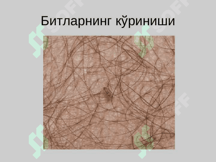 Битлаш (педикулёз) 7