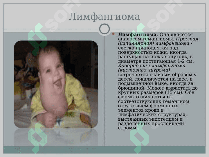 Mezenxemal oʻsmalar . xavfli va xavfsiz 8
