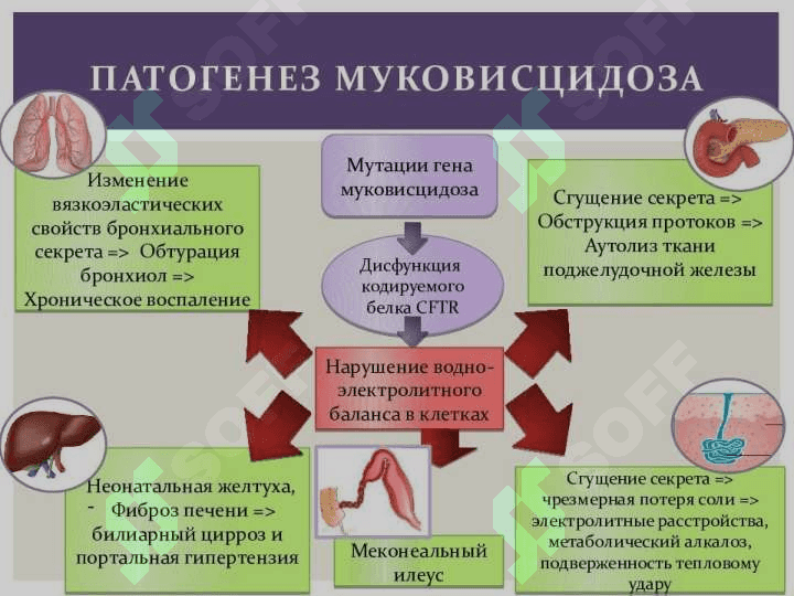 Mukovitsidoz 6
