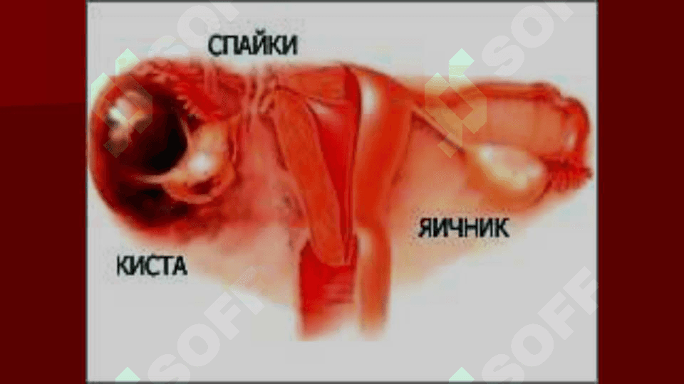 Tuxumdonning xavfsiz va xavfli ósmalari 7