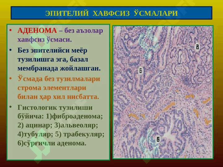 Ўсмалар. Мезенхимал ўсмалар 3