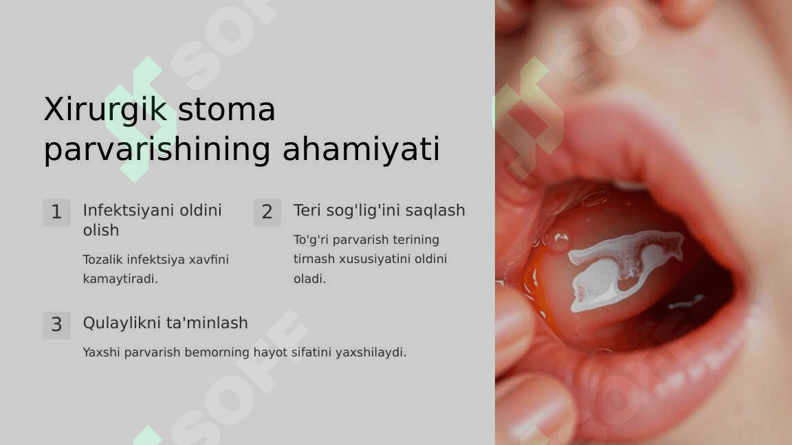 Xirurgik stomani parvarish qilish 3