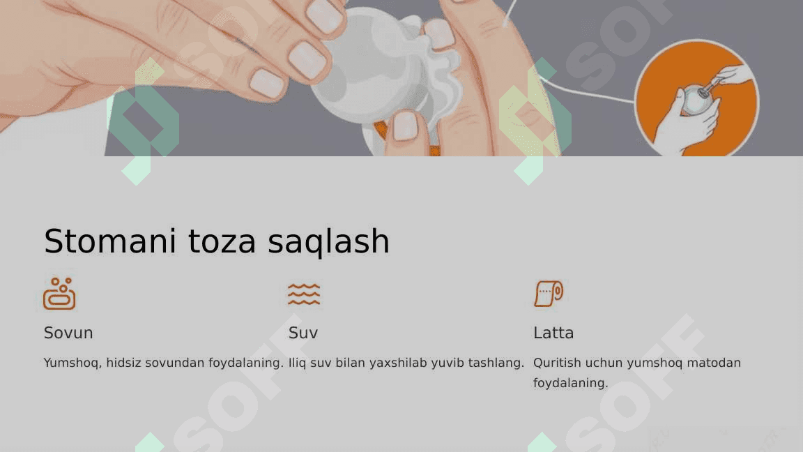 Xirurgik stomani parvarish qilish 4