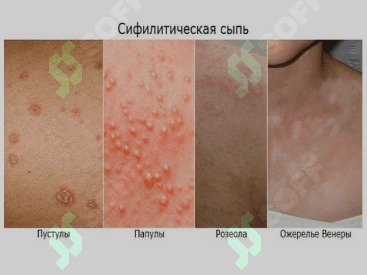Захм диагностикаси 8
