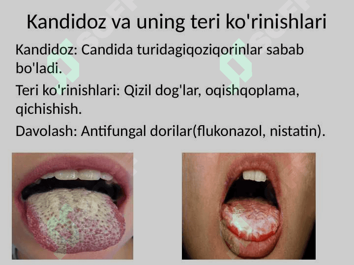 OITSda_Teri_Kasalliklari_Taqdimoti 5