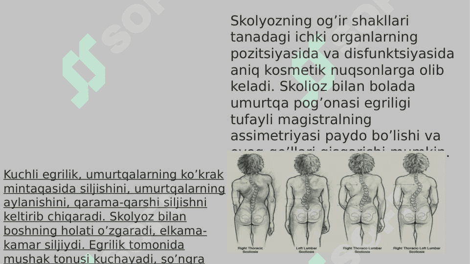 Skalioz 7