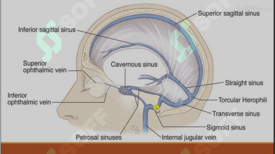 Kavernoz sinus sindromi 3