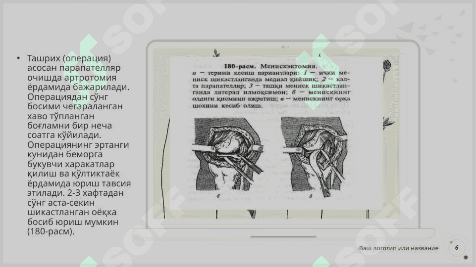 ТИЗЗА БЎРИМИШИКАСТЛАНИШЛАРИ 6