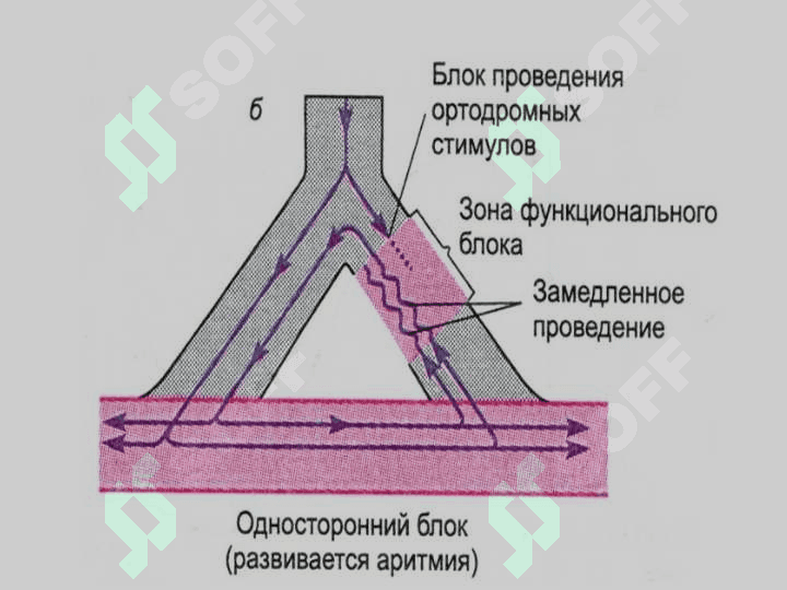 Аритмия 7