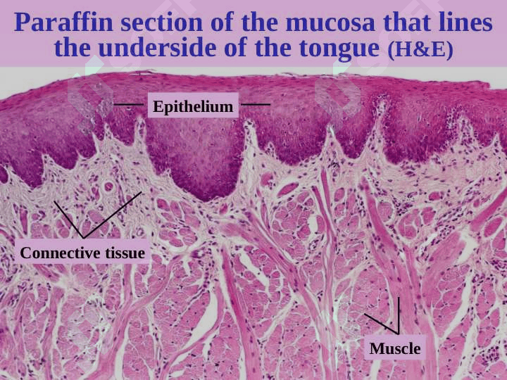 Epitheliume 3