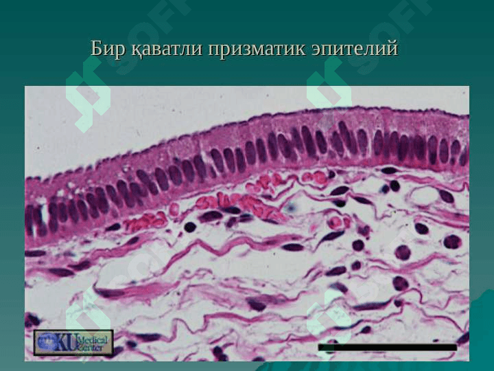 ЭПИТЕЛИЙ ТЎҚИМАСИ 8