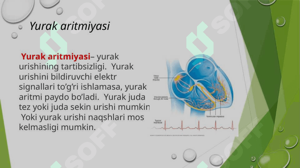 Yurak aritmiyalari EKG diagnostikasi 2