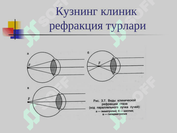 klinik refraksiya. ppt 5