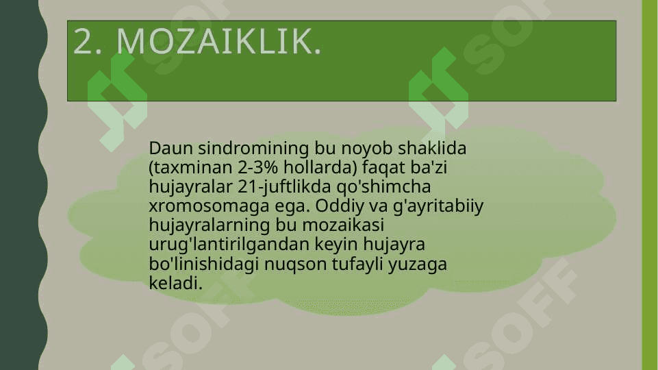 Daun sindromli bolalar 7