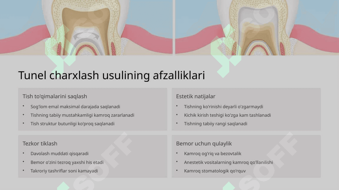 Tunel charxlash usuli. 4