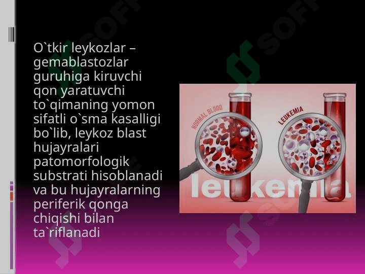 O'TKIR LEYKOZLAR 2