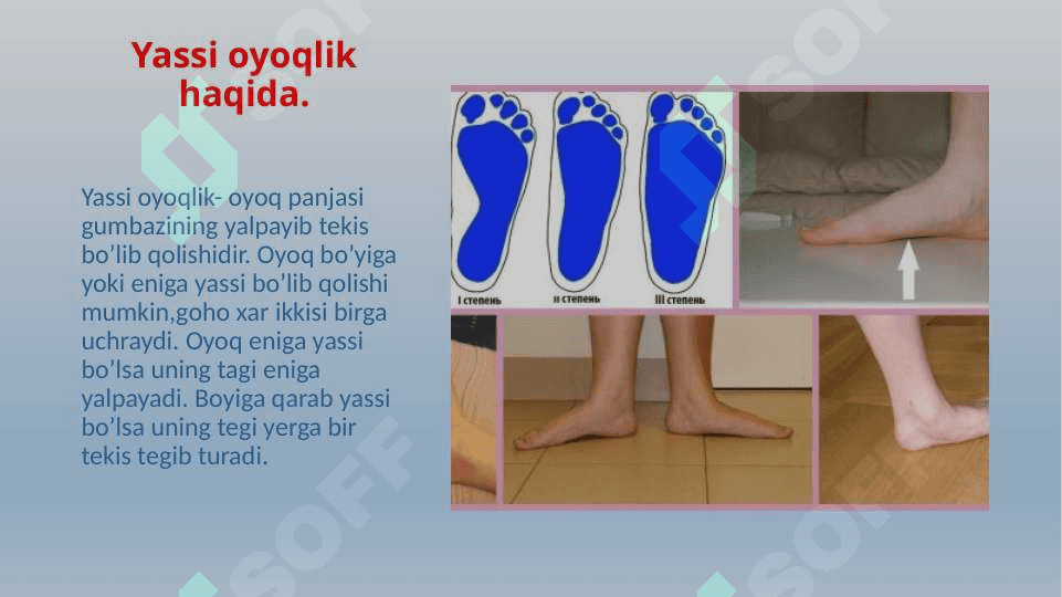 Yassi oyoqlik 2