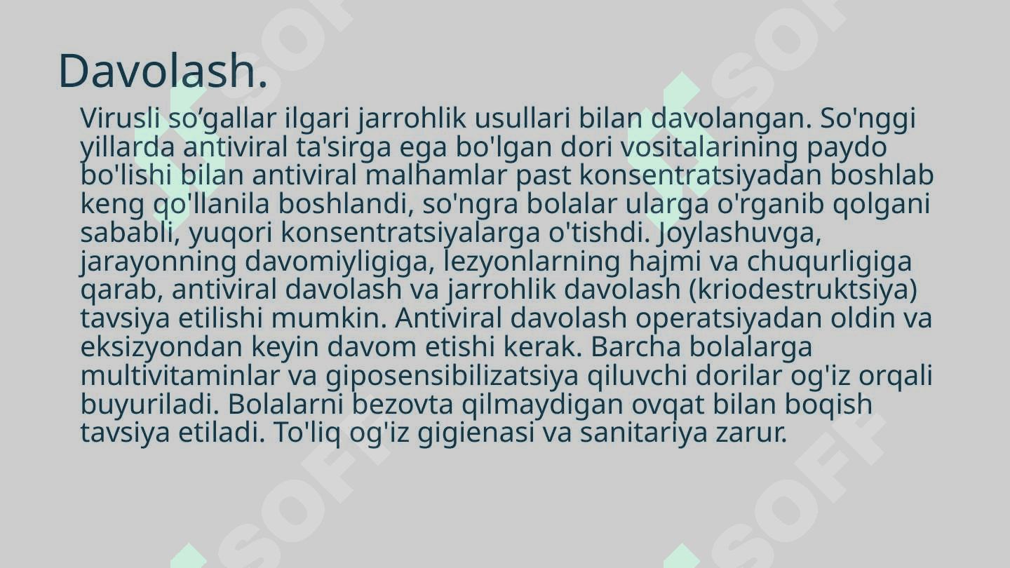 Virusli so’gallar, Mononukleoz 6