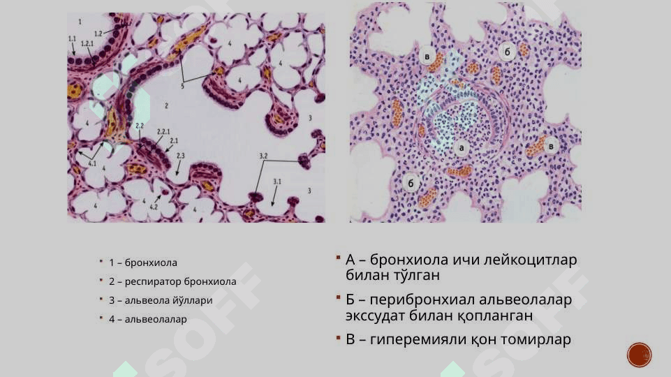 Oʻpka kasallilari patanatomiya 7
