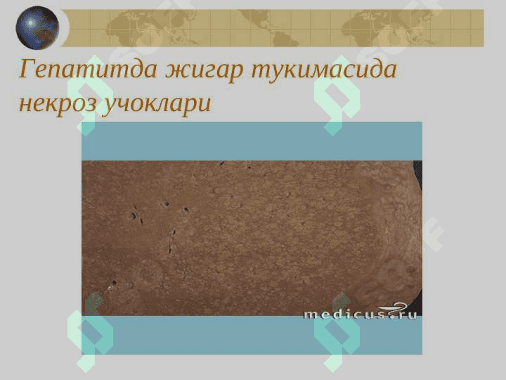 СУРУНКАЛИ ГЕПАТИТ 8