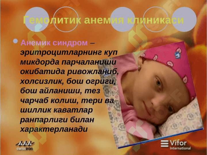 Гемолитик  анемия 3