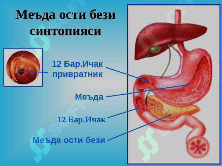 Уткир ва сурункали меъда ости бези касалликлари 6
