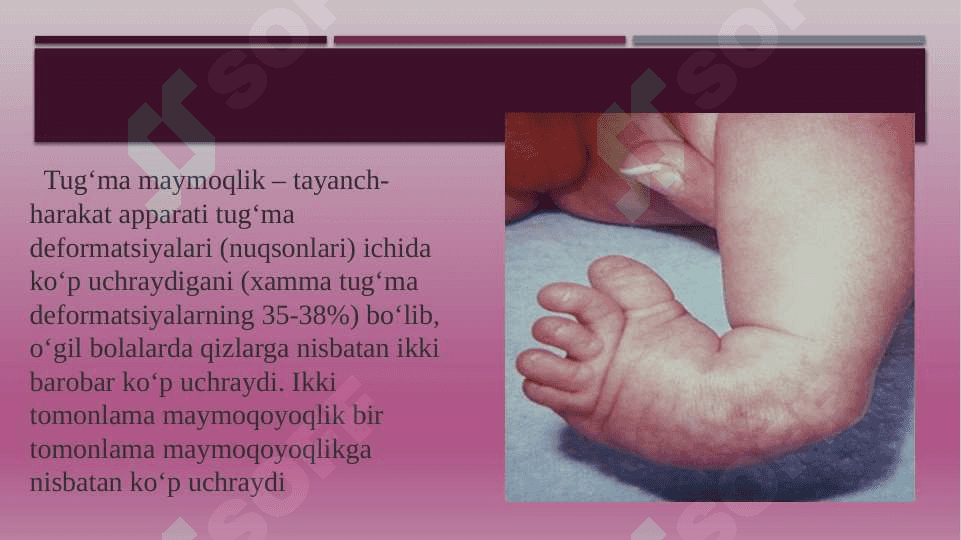 Tug`ma maymoqoyoqlik 2
