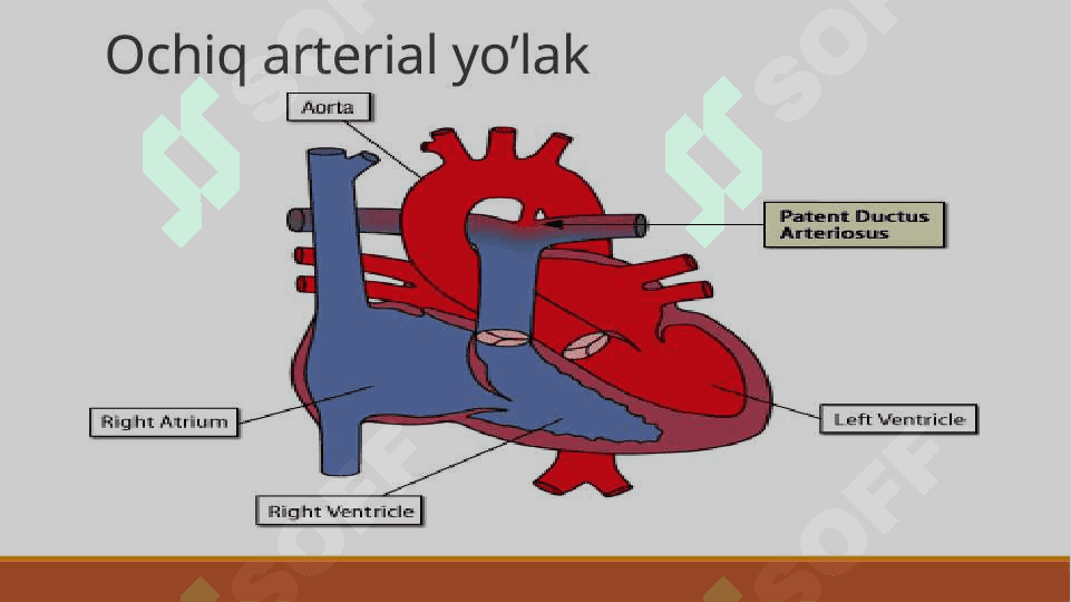 Yurak poroklari (nuqsonlari). Porok turlari, ularda qon aylanishning asosiy ko’rinishlari - Юрак пороклари (нуқсонлари). Порок турлари, уларда қон айланишнинг асосий кўринишлари 8