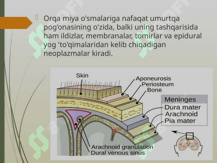 Orqa miya o’smalari 2