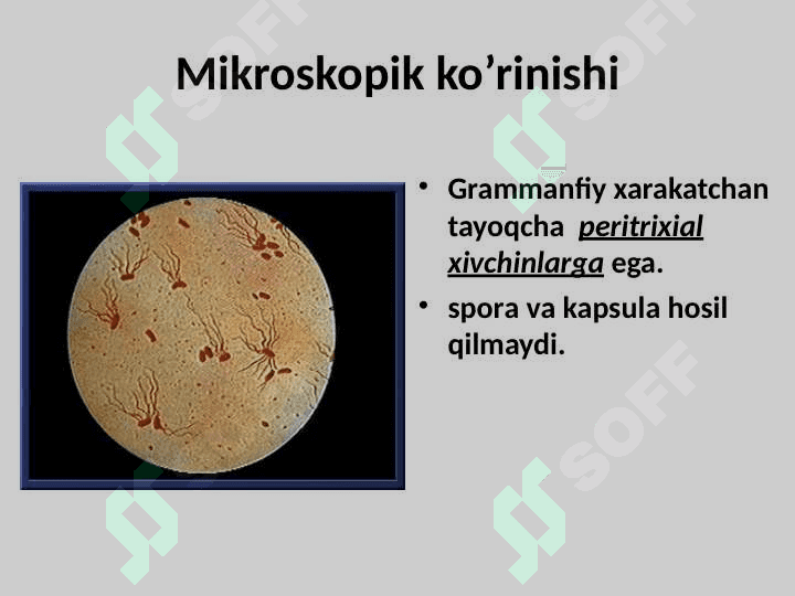 TIFOPARATIFOZ KASALLIKLAR 6
