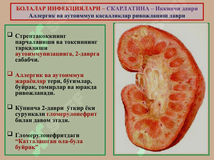 ИНФЕКЦИОН  КАСАЛЛИКЛАР 8
