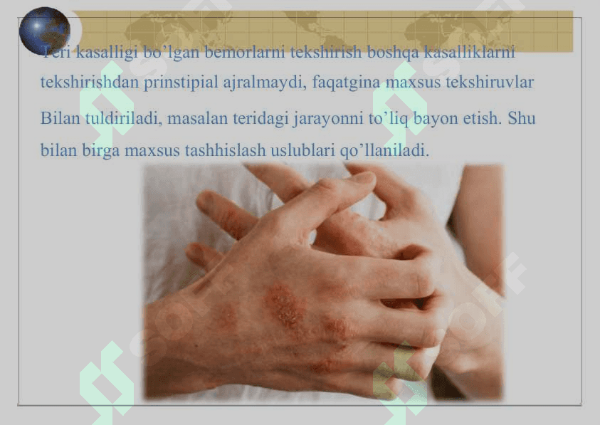 TERINING DERMATOZLAR NASLIY KASALLIKLARI QANDSIZ DIAPED KASALLIGI 4
