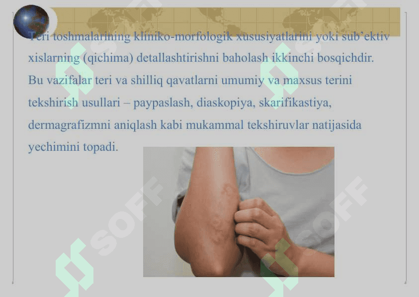 TERINING DERMATOZLAR NASLIY KASALLIKLARI QANDSIZ DIAPED KASALLIGI 7