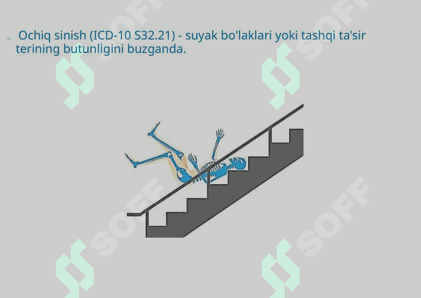 DUM SUYAGI TRAVMASI POSTARVMATIK KOKTSIGODINIYA 5