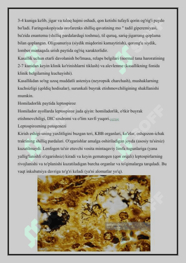 LEPTOSPIROZLAR MORFOLOGIYASI STRUKTURASI TARQANGANLIGI KELTIRIB CHIQARUVCHI KASALLIKLARI LABORATORIYA DIAGNOSTIKASI 7