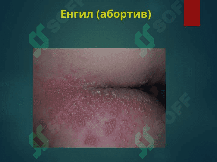 Ўраб олувчи темиратки. orab oluvchi temiratki 7