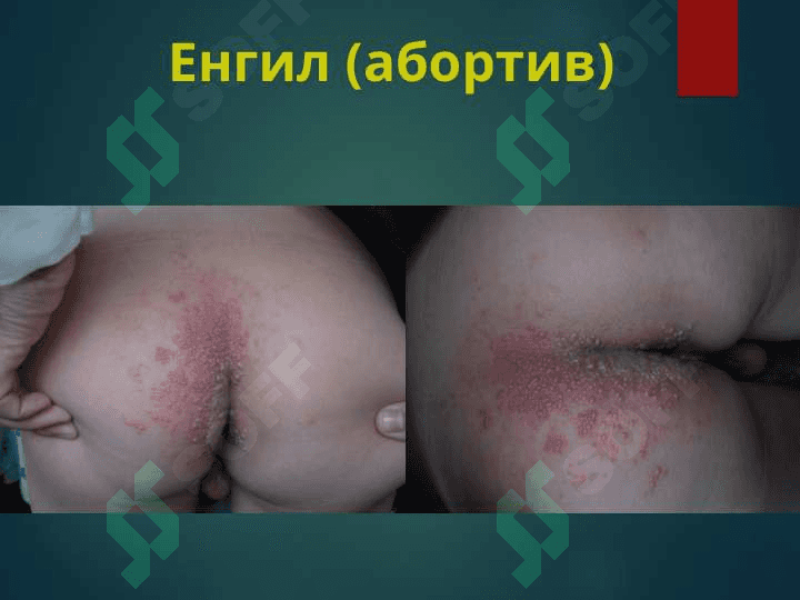 Ўраб олувчи темиратки. orab oluvchi temiratki 8