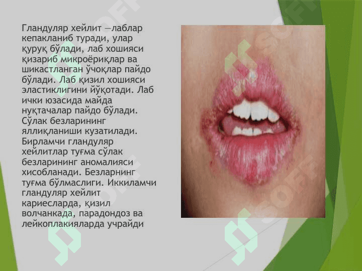 Ҳейлит . xeylit 8