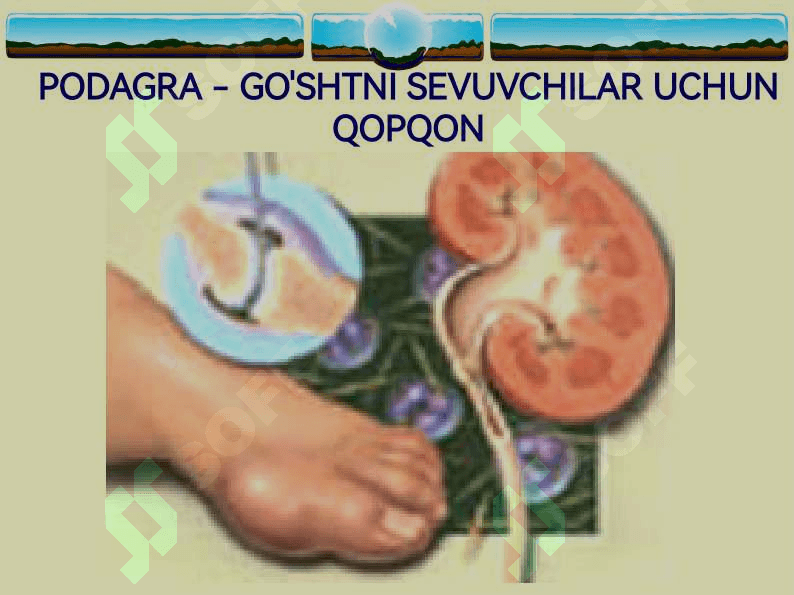 Podagra 3