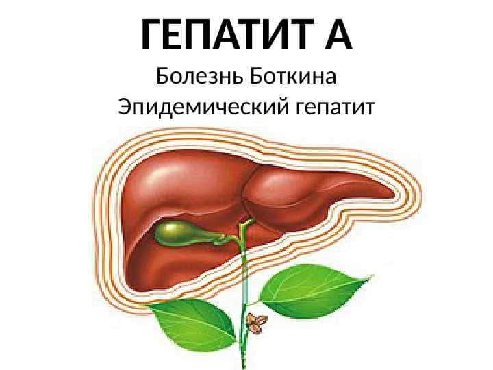 ГЕПАТИТ АБолезнь БоткинаЭпидемический гепатит