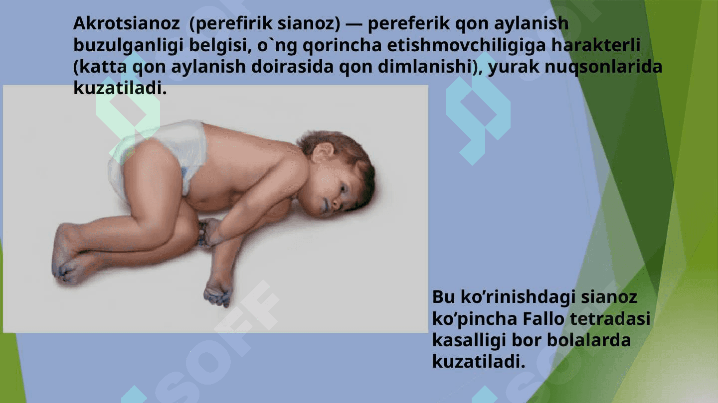 Bolalarda yurak qon tomir kasalliklarini diagnostikasi va differensial  diagnostikasi. 4